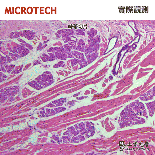 MICROTECH 100 pieces-biological biopsy specimen set-with storage box