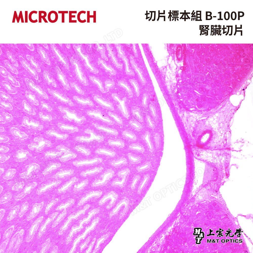 MICROTECH 100 pieces-biological biopsy specimen set-with storage box