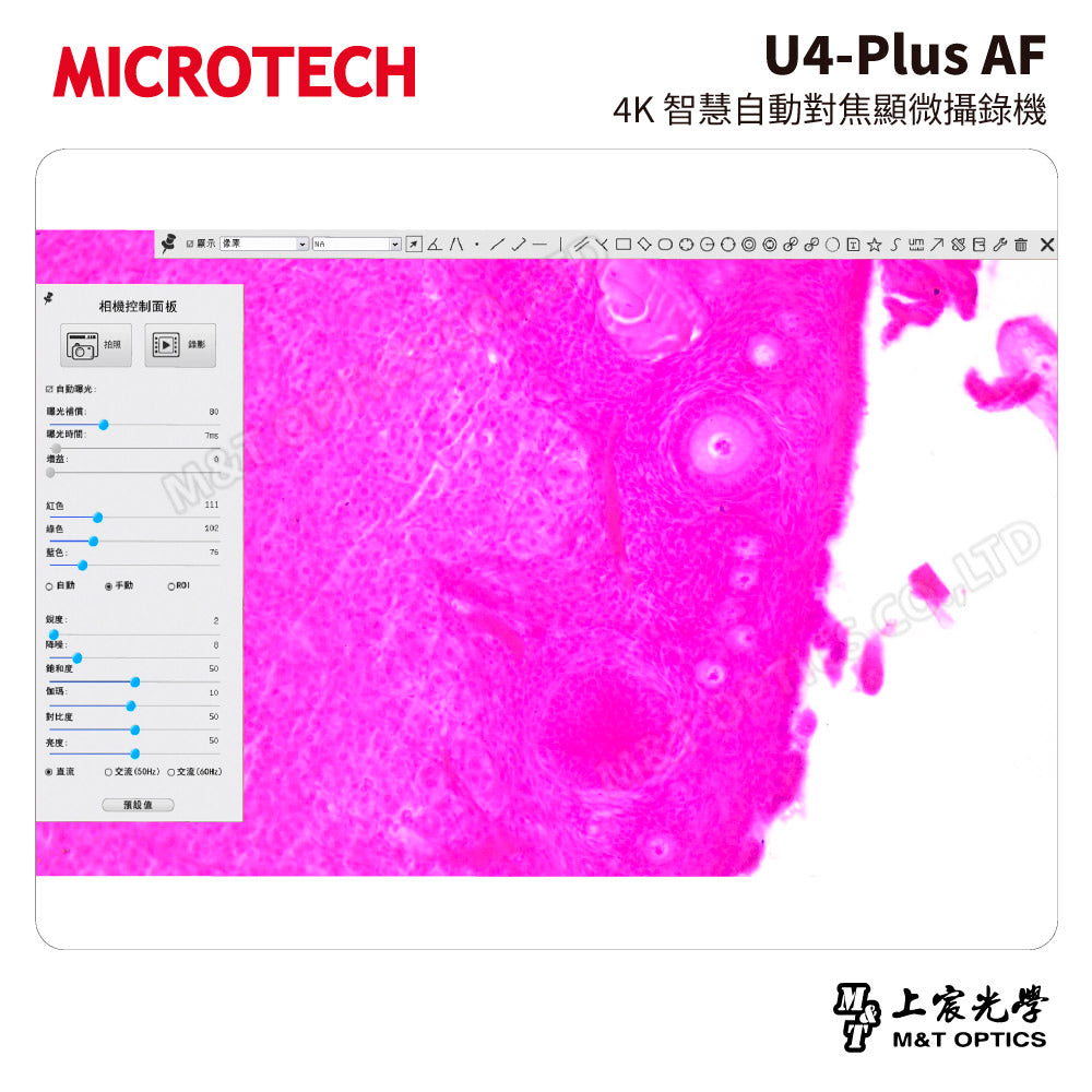 MICROTECH U4-Plus AF 4K智慧自動對焦顯微攝錄機