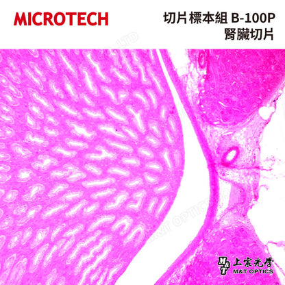MICROTECH 100 pieces-biological biopsy specimen set-with storage box